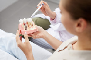 Bone Grafting