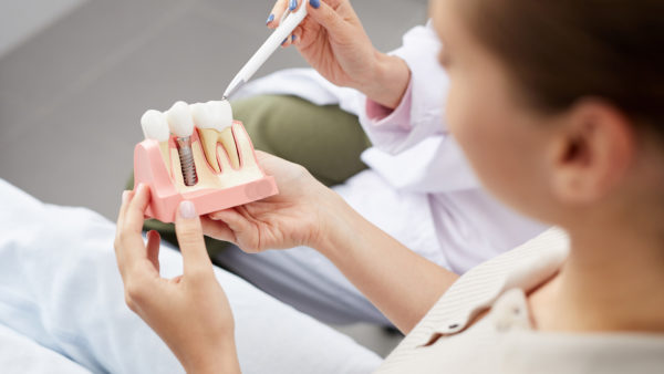 Bone Grafting