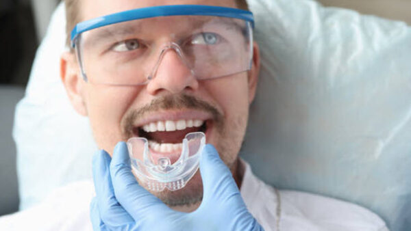 Why You Might Need a Custom Nightguard for Bruxism Relief