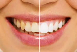 Pascack Valley Dental