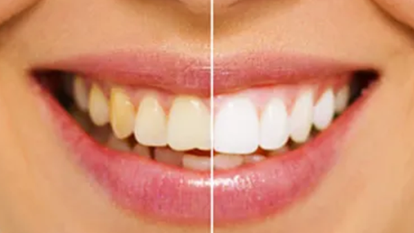 - Pascack Dental Arts Pascack Valley Dental