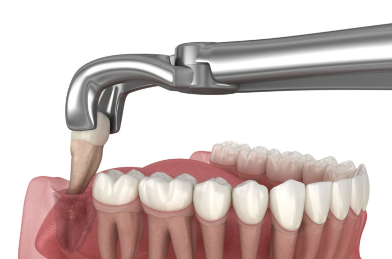 Pascack Dental