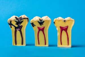 Pascack Dental