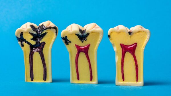 Pascack Dental