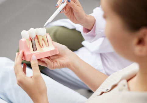 Bone Grafting