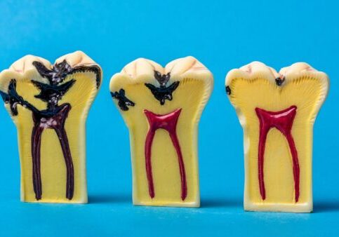 Pascack Dental