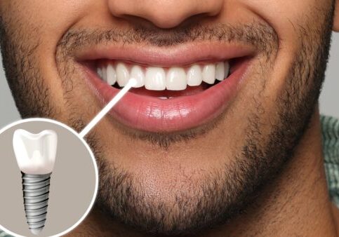 Happy,Man,With,Perfect,Teeth,Smiling,On,Grey,Background,,Closeup.